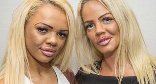 Madre e hija adictas a la cirugía