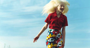 El fotógrafo que dejó la moda para fotografiar personas con discapacidad genética