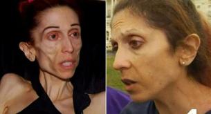 La increíble recuperación de la actriz anoréxica que pidió ayuda en la red