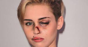 Famosas maltratadas contra la violencia de género