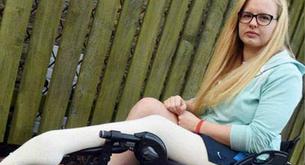 Esta deportista suplica que le corten la pierna