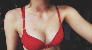 5 razones para dejar de hacer chupetones