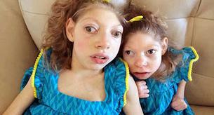 Creían que no sobrevivirían, pero viven felices a pesar de su enfermedad