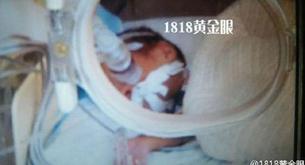 Bebé al que habían dado por muerto comienza a llorar justo antes de incinerarlo