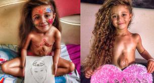 Esta niña nació con el corazón fuera del pecho
