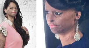 Esta superviviente a un ataque de ácido es la imagen de una firma de moda