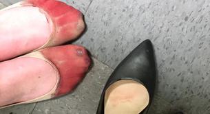 Así pueden acabar tus pies cuando te obligan a trabajar con tacones