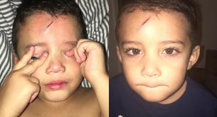 Lo que esta madre hizo para tapar la cicatriz de su hijo ha conmovido a las redes