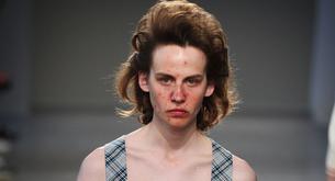 El acné, la última tendencia en las pasarelas
