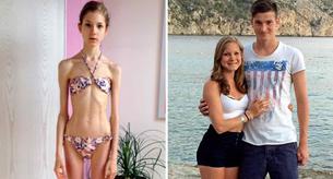 Asegura que el amor la salvó de la anorexia