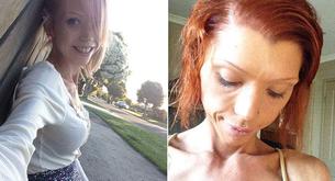 Su novio la obligó a volverse anoréxica