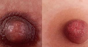 Esta cuenta reta a Instagram a saber si son pezones de mujeres o de hombres