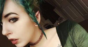 Cirugías otoplastia insólitas