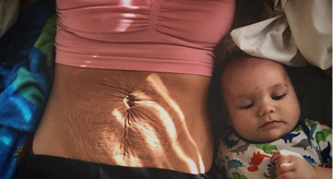 Comparte las marcas de sus dos embarazos para animar a otras madres a sentirse guapas