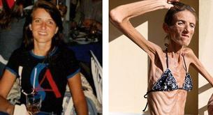 Valeria Levitiva: la mujer más delgada de la historia