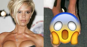 Descubre a las 11 famosas con los pies más feos