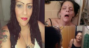 Comparte sus fotos de cuando era heroinómana para concienciar a la población