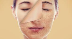 ¿Qué es el ácido glicólico y para qué sirve?