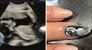 Arrasa entre las embarazadas la manicura con ecografía
