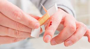 ¿Qué hacer cuando te haces una herida en casa?