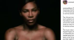 Serena Williams en topless canta por el cáncer de mama
