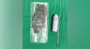 Mujer transgénero con una vagina de piel de pez